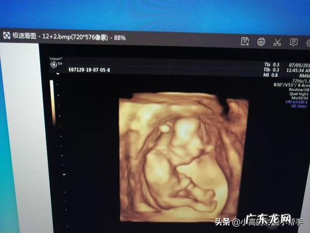 B超和彩超有什么区别?