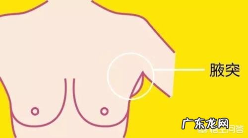 怎样才能把副乳去掉？