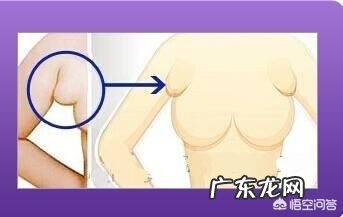 怎样才能把副乳去掉？