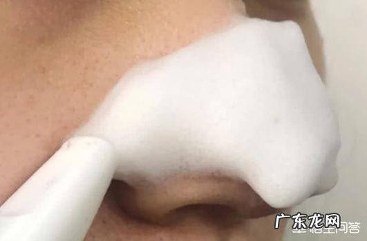 鼻子上黑头超级多该怎么办呢?