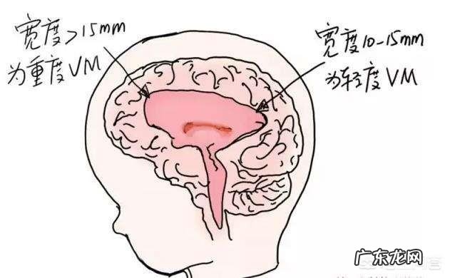 37周胎儿双顶径98mm正常吗?