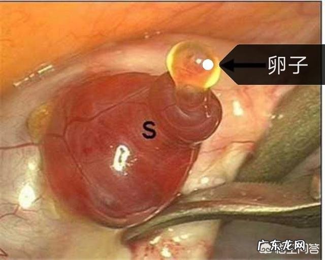 想问一下排卵期的症状是怎么样的呢?