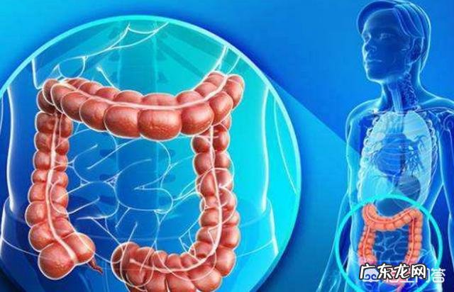 中期直肠癌没有转移能治愈吗?需要注意些什么?