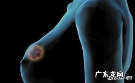 什么是乳腺增生?