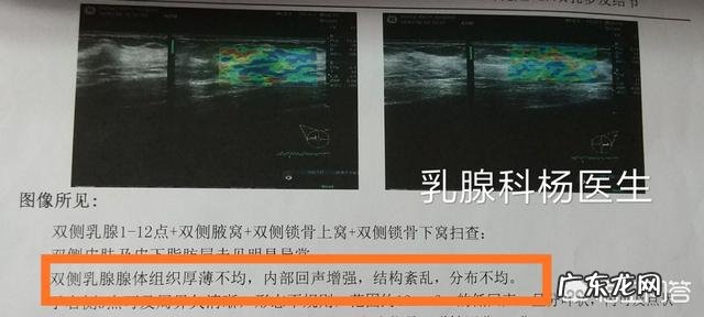 什么是乳腺增生?