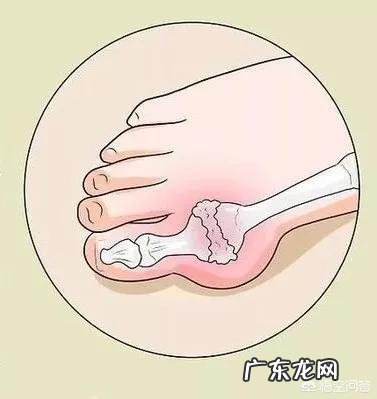 每天喝500毫升啤酒,有什么好处和坏处?