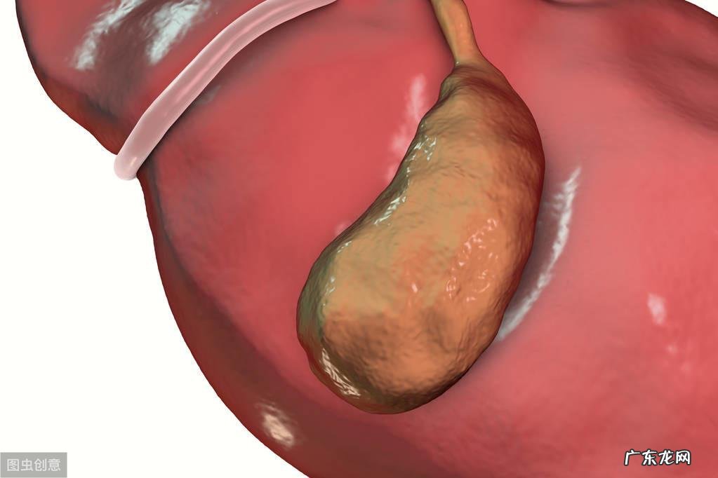 胆囊炎有几种治疗方法 胆囊炎治疗方法