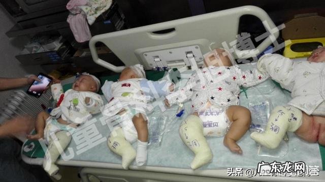 宝宝双足内翻如何护理?