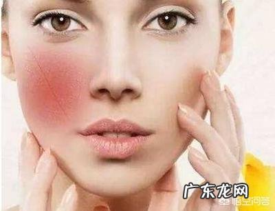 如何修护敏感肌红血丝?