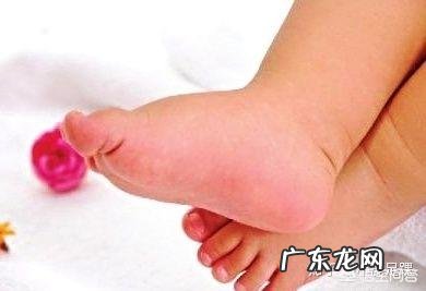 宝宝扁平足需要怎样判断及有哪些危害?