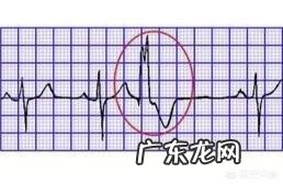 正常的心脏心电图会出现非特异性ST段、T波异常吗?