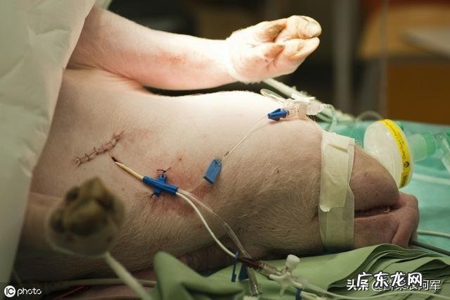 养猪户如何分辨饲养猪是否得了弓形虫疾病，如何用药？