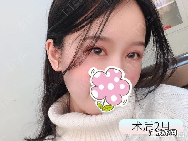 双眼皮拆线会疼吗 ？