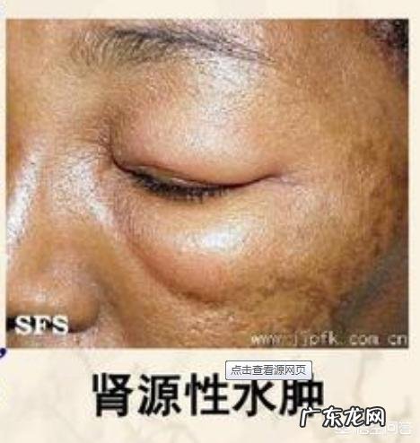 肾不好，主要表现在哪些方面？