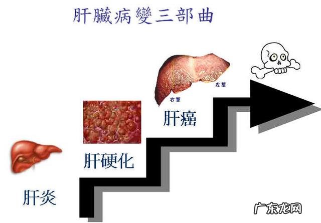 肝纤四项检查在确定肝硬化中有什么作用?
