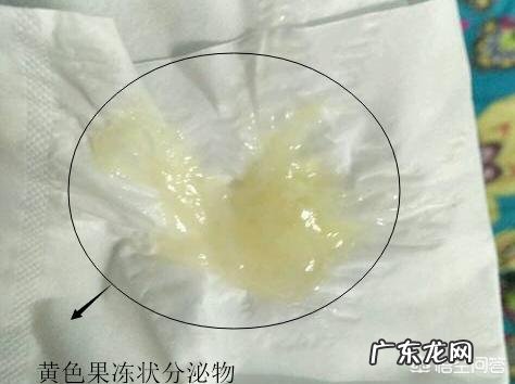 孕39周,晚上上厕所,发现有黄色果冻状的分泌物,是什么情况?应该怎么办?