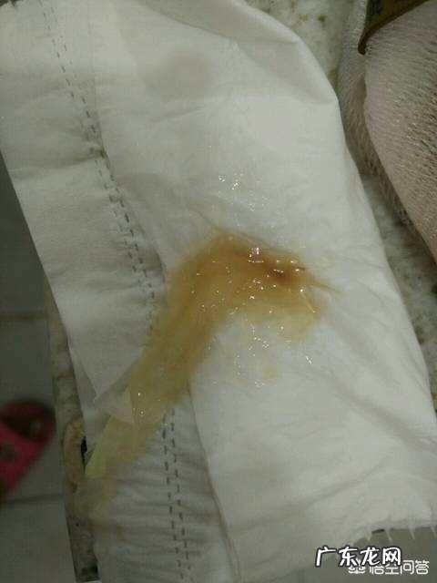 孕39周,晚上上厕所,发现有黄色果冻状的分泌物,是什么情况?应该怎么办?