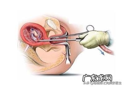 人流对身体的危害大吗？