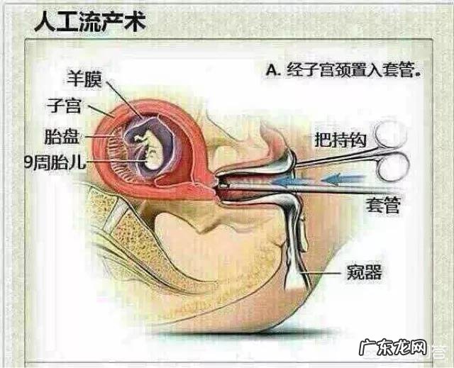 人流对身体的危害大吗?