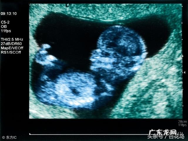 B超对胎儿有影响么?