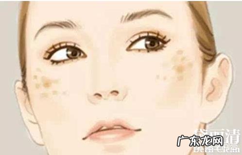 脸上长雀斑的原因有哪些？