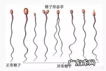 精子畸形率99%,能顺利怀孕吗?