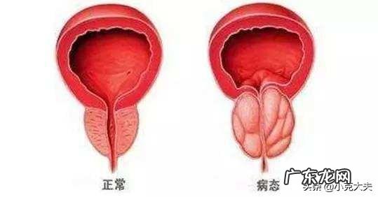 吃南瓜子对前列腺有什么好处?