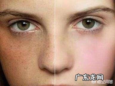 什么化妆品祛斑效果好?