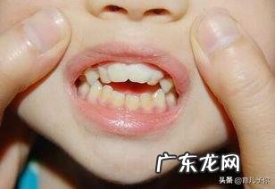 婴幼儿地包天怎么办?