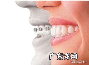 婴幼儿地包天怎么办?