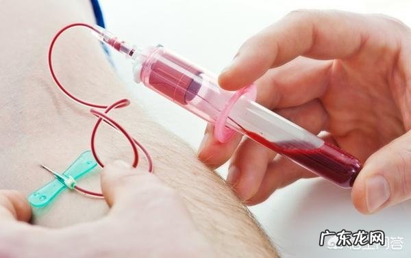 性激素六项是什么检查呢?有没有必要做呢?