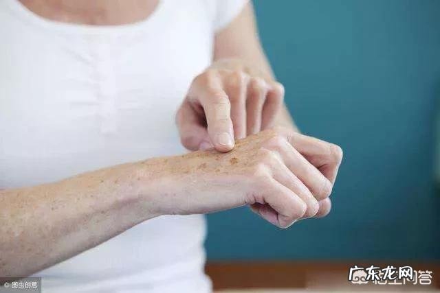 黄褐斑、雀斑、老年斑、颧骨褐青痣发生形成的原因是什么?