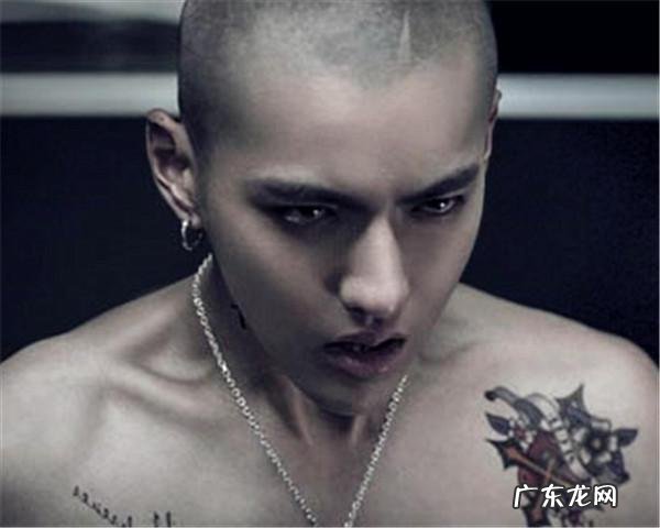 为什么网上说大家千万不要植发?