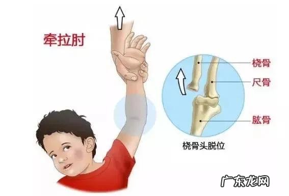 宝宝不小心摔到后脑勺了会怎么样 怎么判断小孩摔后没事需要几天