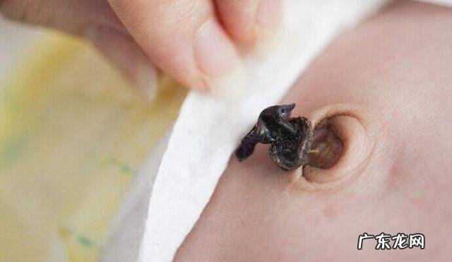 新生儿刚出生一周左右，需要注意哪些事项？