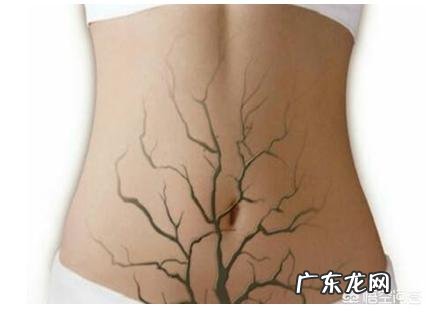 宫颈炎的成因都有什么?