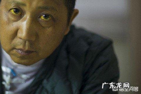 肝不好,身体会有“1痛2臭3变色”,指的是什么?