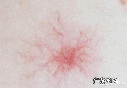 肝不好，身体会有“1痛2臭3变色”，指的是什么？