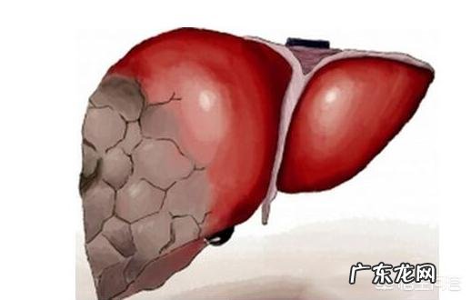 肝不好,身体会有“1痛2臭3变色”,指的是什么?