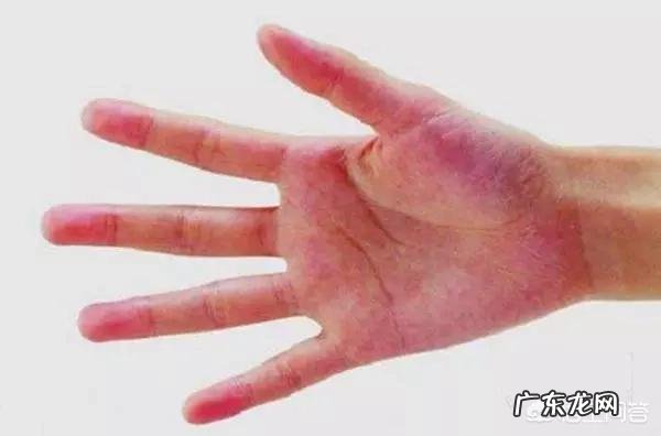 肝不好,身体会有“1痛2臭3变色”,指的是什么?