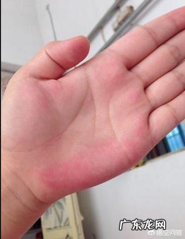 肝不好,身体会有“1痛2臭3变色”,指的是什么?