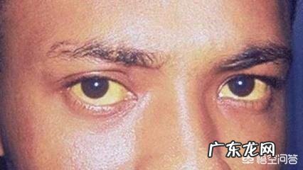 肝不好，身体会有“1痛2臭3变色”，指的是什么？