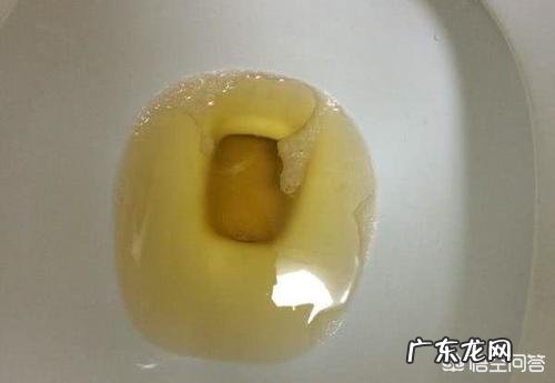 肝不好，身体会有“1痛2臭3变色”，指的是什么？