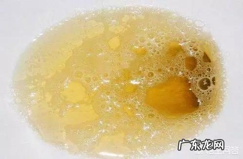 肝不好,身体会有“1痛2臭3变色”,指的是什么?