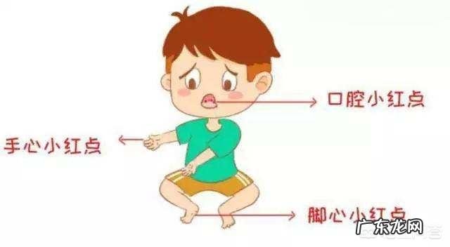 手足口病多发期,要怎么给宝宝做好预防?