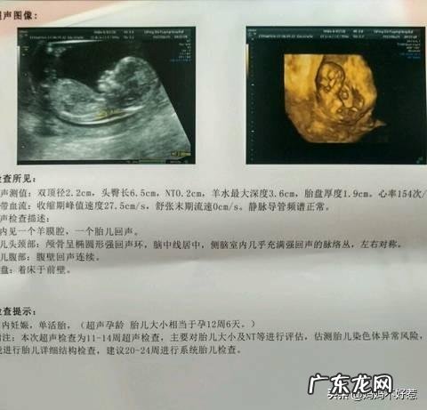 怀孕前三个月应该注意什么?