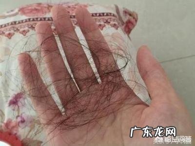 女的掉头发特别厉害是什么原因?应该注意什么问题?