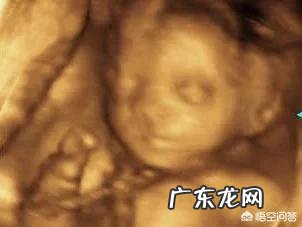 胎儿出现脐带绕颈,跟孕妇睡觉姿势有关吗?