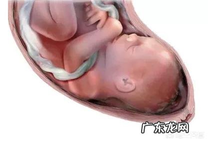 胎儿出现脐带绕颈，跟孕妇睡觉姿势有关吗？