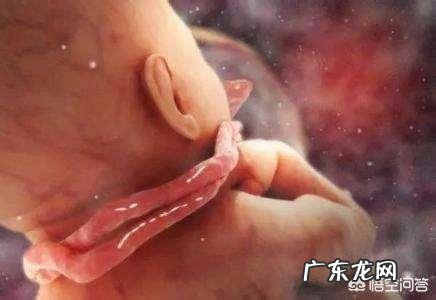 胎儿出现脐带绕颈,跟孕妇睡觉姿势有关吗?